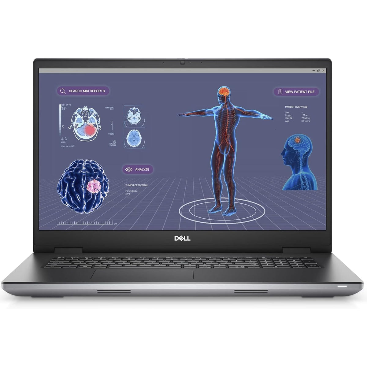 Dell Precision 7680 16" FHD+ Workstation - i7-13850HX, 32GB, RTX 3500 ADA (Refurbished)